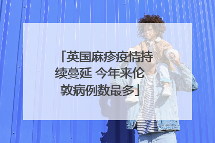 英国麻疹疫情持续蔓延 今年来伦敦病例数最多
